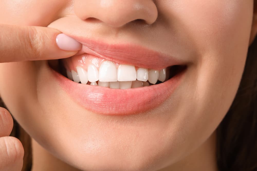  Revitalize Gum Health & Prevent Tooth Decay: Exploring the Impact of Eating Habits on Oral Wellness