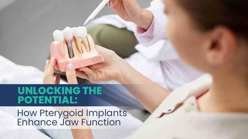  Unlocking the Potential: How Pterygoid Implants Enhance Jaw Function