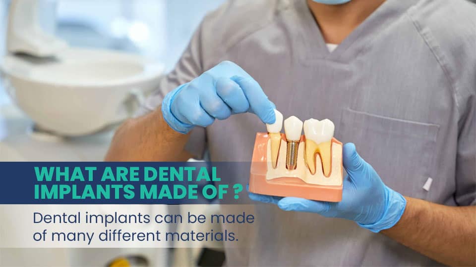  What Are the Best Materials for Dental Implants?