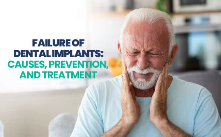 Failure of Dental Implants: Causes, Prevention, and Treatment